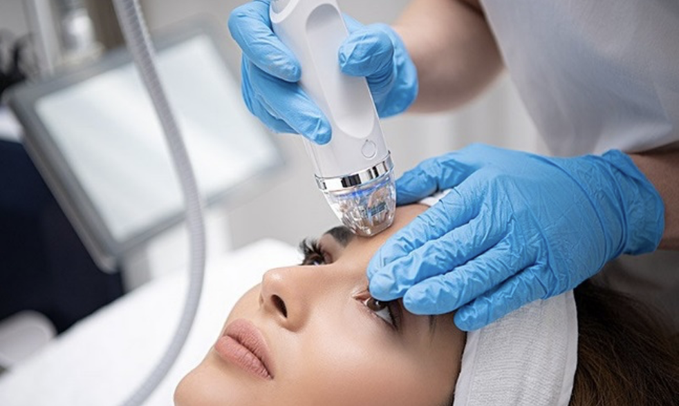 Microneedling, Radio Frequency Microneedling